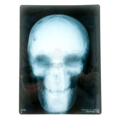 Lot # 170: Frank Castle's Head X-Ray